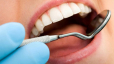 Отбеливание зубов - AMALS SIA, zobārstniecība un skaistumkopšana